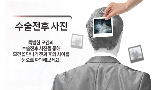 전/후사진 상단 이미지